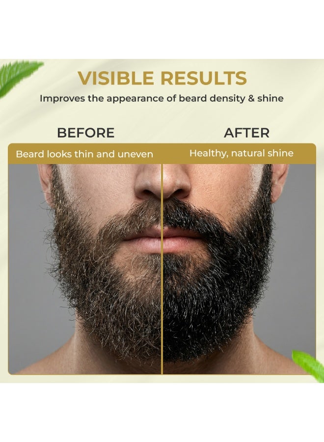 SZ Star Beard Oil 100ml - Beard Growth Oil for Thicker Beard, Natural Beard Conditioner & Beard Softener with Avocado, Almond & Sesame Oils, Beard Itch Relief & Nourishing Facial Hair Care for Men - Image 5